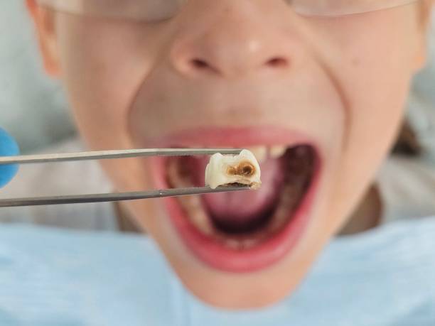 Best Emergency Broken Tooth Repair in Newport, RI