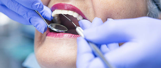 Best Emergency Wisdom Teeth Removal in Newport, RI